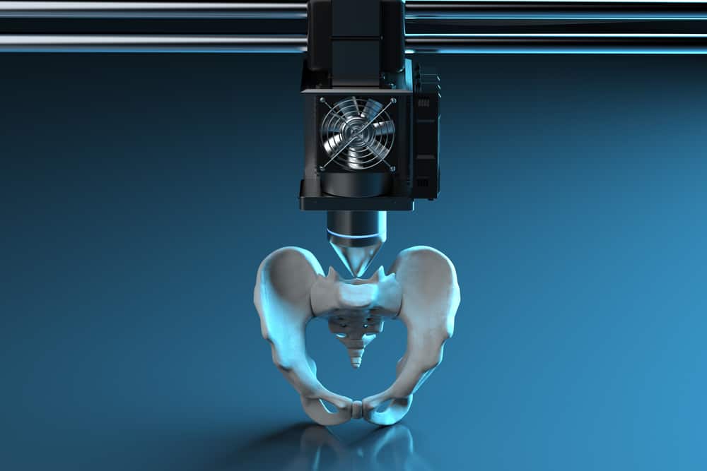 3d printer print prosthetic hip bone